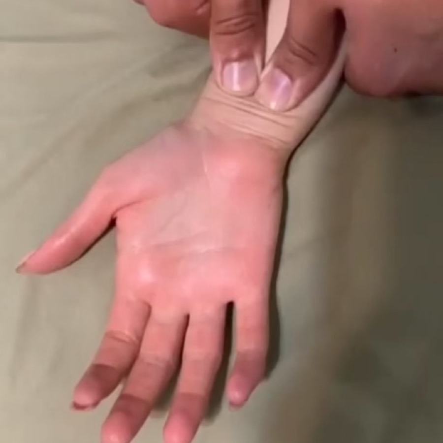 Manovra sul polso e sul palmo della mano